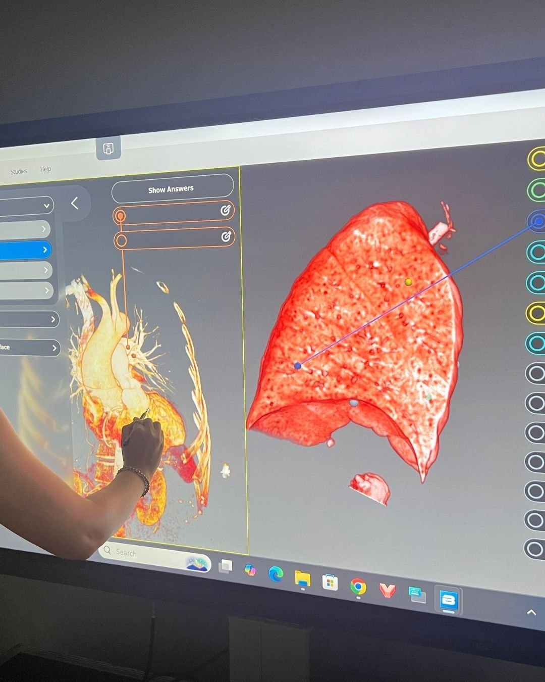 Split Screen Anatomy Table