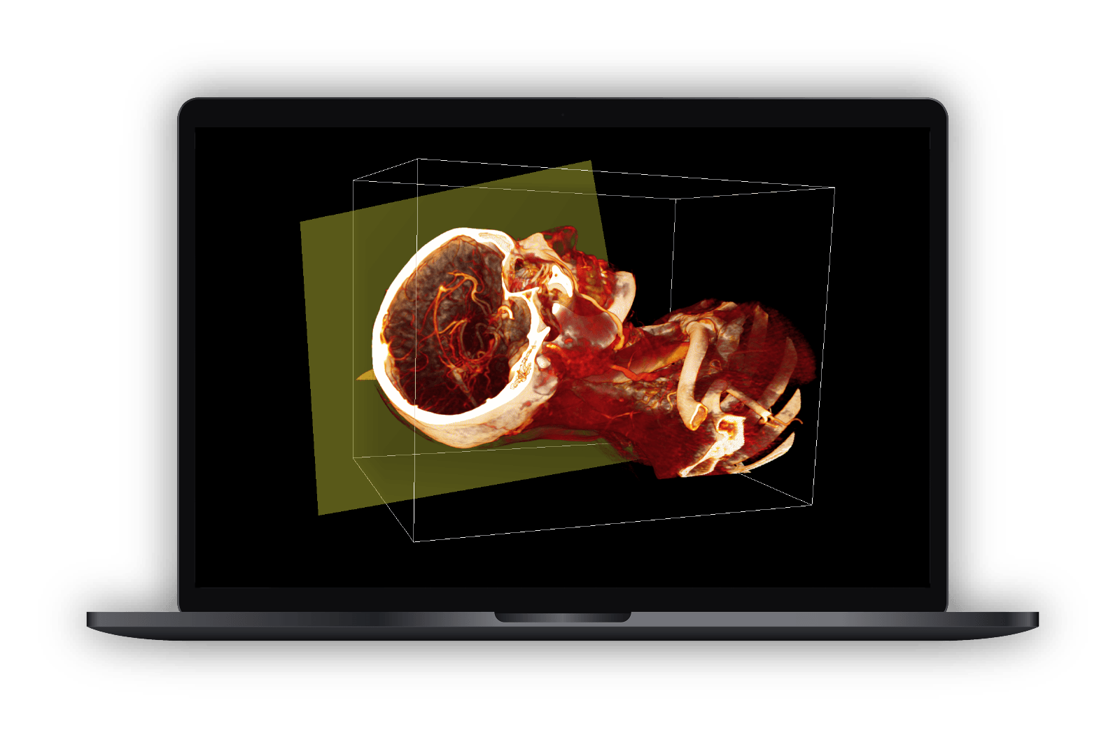 instructor-3d-anatomy-software-license