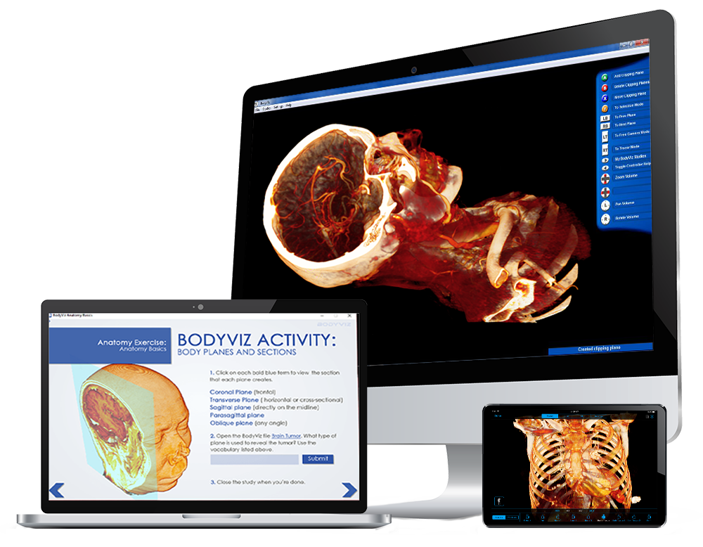 3D anatomy scans on BodyViz computers