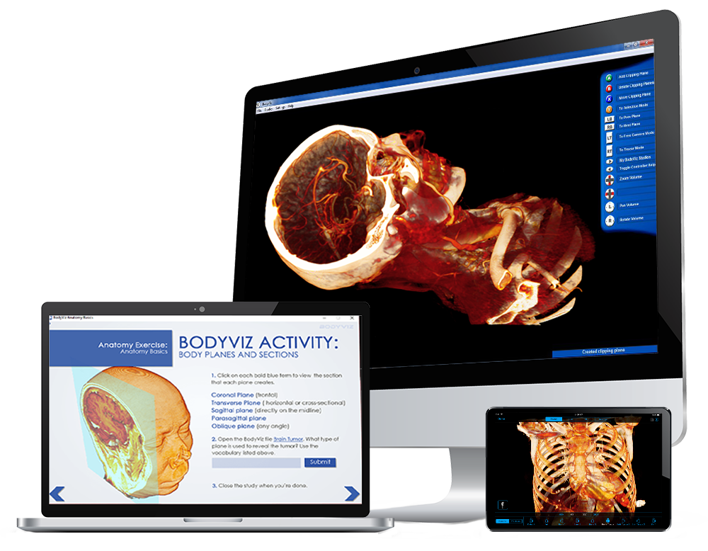 The Importance of Anatomical Variations with BodyViz 3D Anatomy